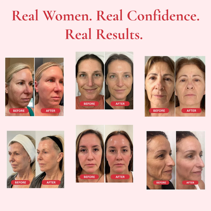 Sorevyn™ Advanced Anti-Aging Hydrating Cream